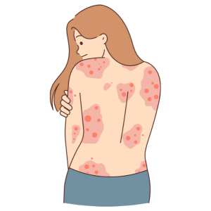 red rashes