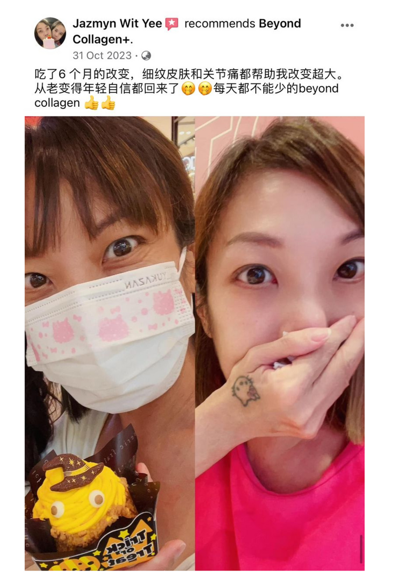 Wrinkles & Fine Lines — Beyond Collagen+ testimonial